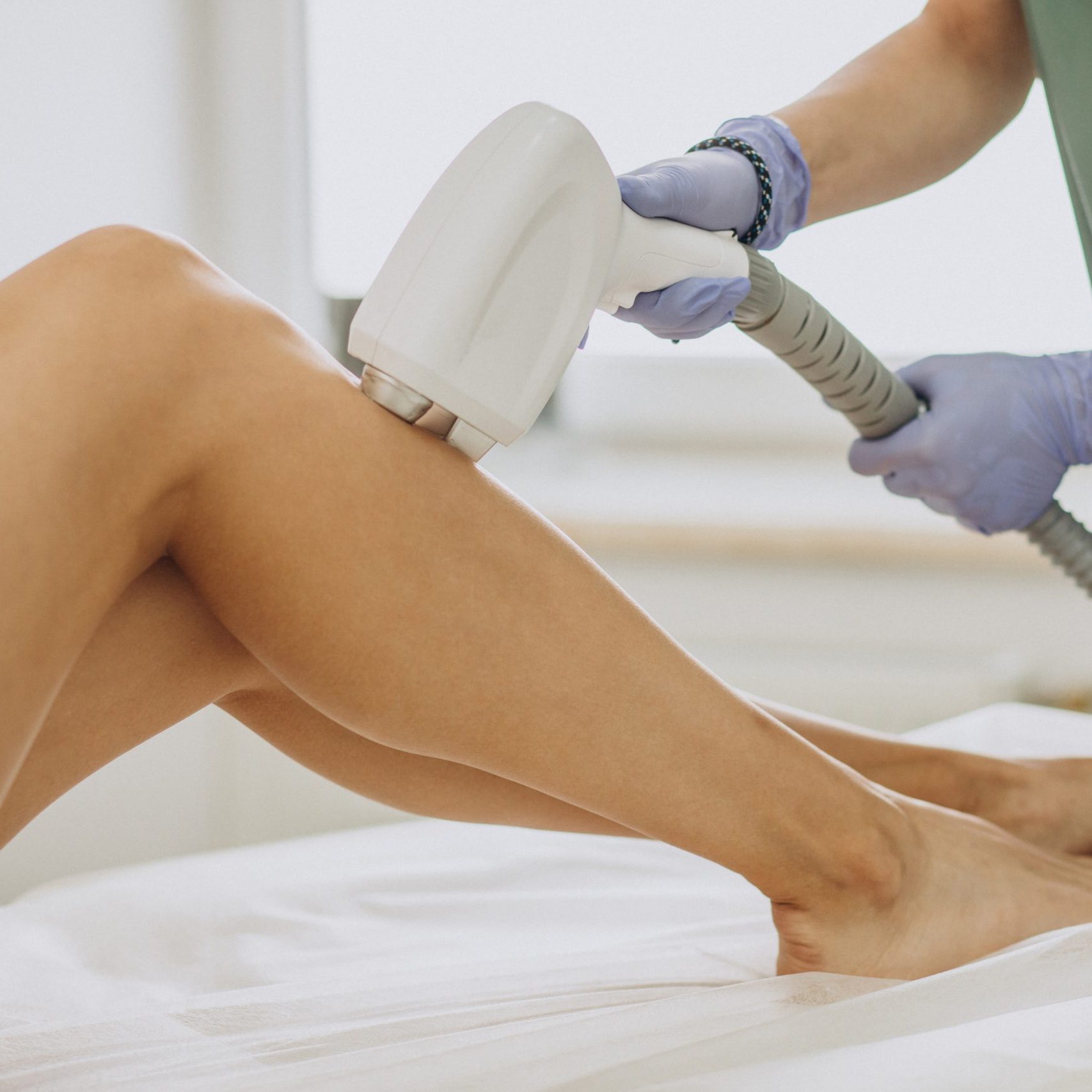 Laser epilation, hair removal therapy
